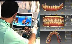 sdfvb55j657j همانطوریکه در تمام جنبه های زندگی امروزی دیجیتالی شده است درمان ایمپلنت دیجیتال نیز جای خود را در بین درمان های دندانپزشکی باز کرده است .